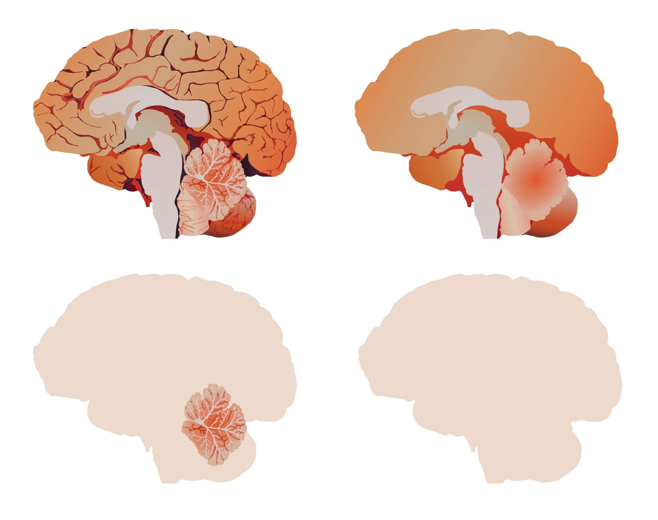 anatomical_brains-15Nov19